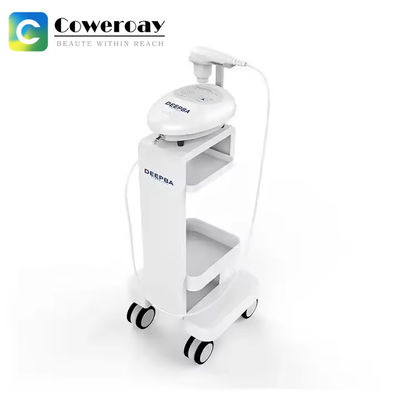 Giá tốt. ẩm nhăn loại bỏ siêu dẫn nước ánh sáng cơ sở Ion máy trực tuyến